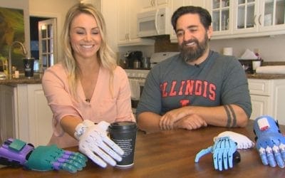 Couple Recycle Plastic Into Prosthetic Limbs